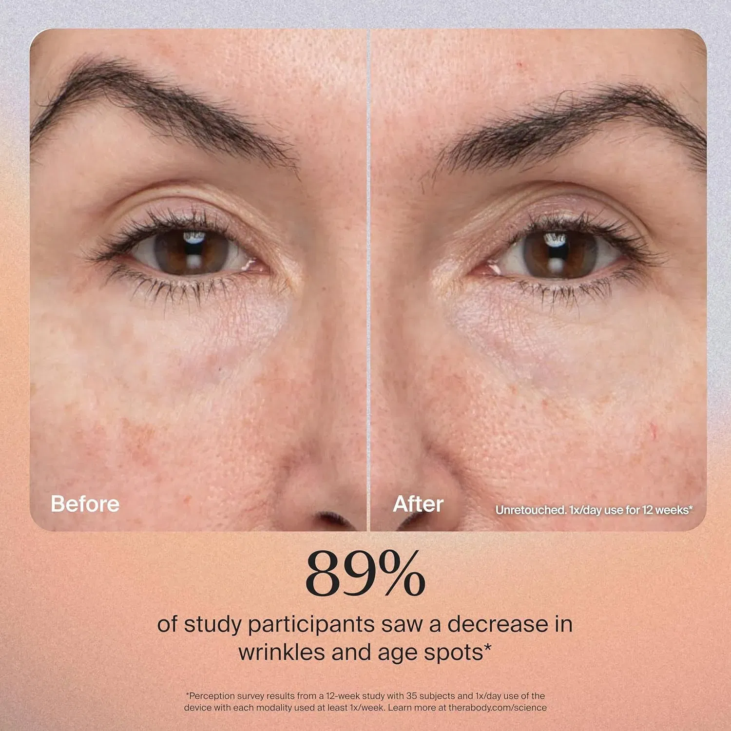 Therabody TheraFace Pro  - White