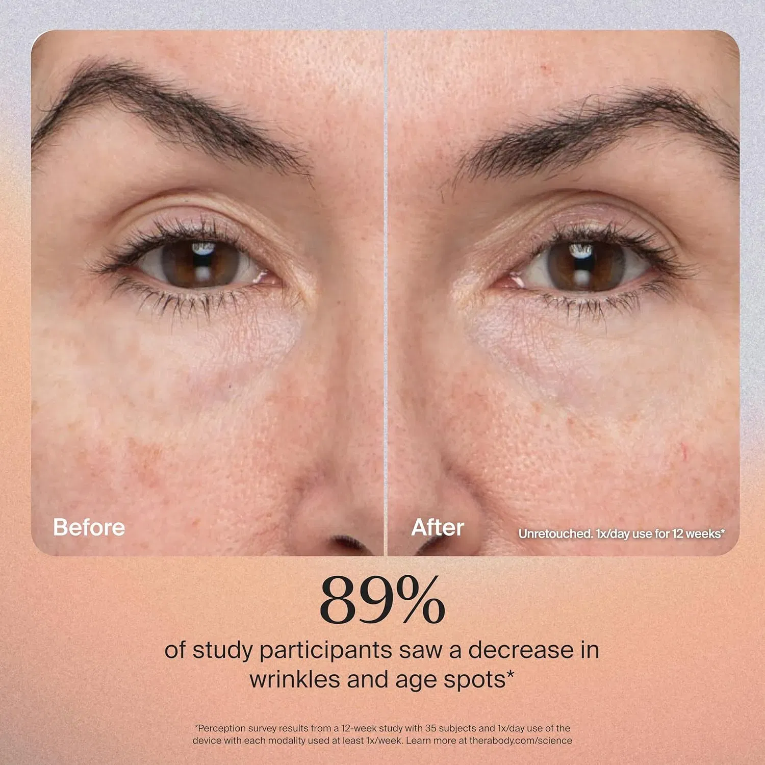 Therabody TheraFace Pro  - Black